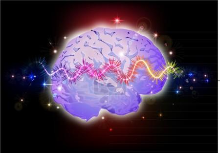 L'AIT, UNE OCCASION EN OR DE PRÉVENIR L'AVC L'AIT, UNE OCCASION EN OR DE PRÉVENIR L'AVC