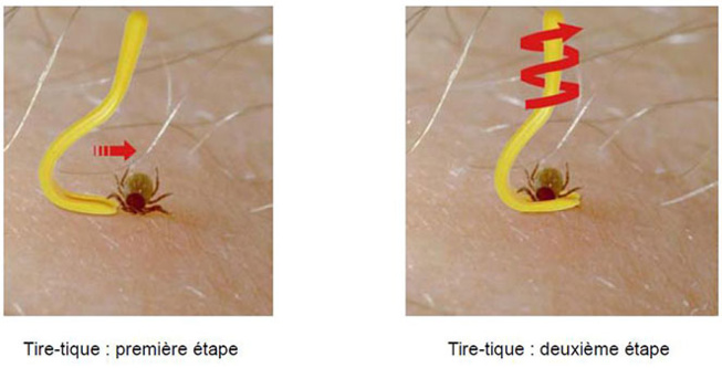 C'EST LA SAISON : REVOILÀ... LES TIQUES C'EST LA SAISON : REVOILÀ... LES TIQUES