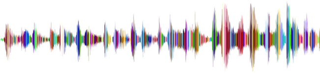 CORRIGER LES PERTES AUDITIVES CORRIGER LES PERTES AUDITIVES