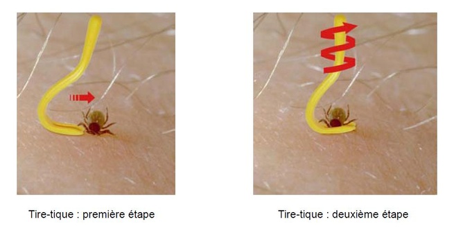 CONNAÎTRE LES TIQUES CONNAÎTRE LES TIQUES